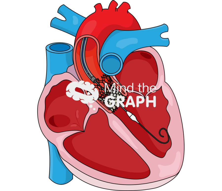 Self expandable transcatheter aortic valve implantation Icons, Symbols, Pictures, and Images