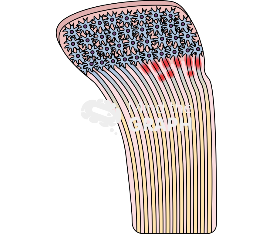 Shear diffuse axonal injury Icons, Symbols, Pictures, and Images