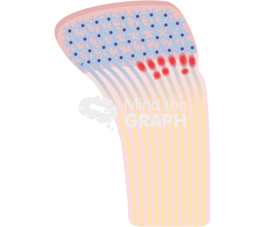 Shear diffuse axonal injury Icons, Symbols, Pictures, and Images