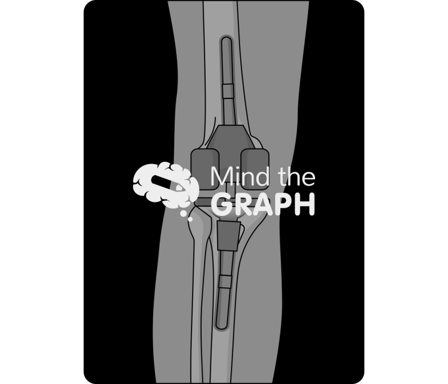 Short cemented stem cone anterior posterior x ray Icons, Symbols, Pictures, and Images