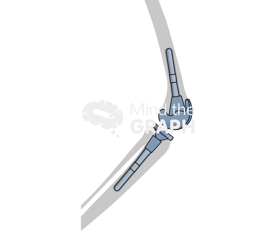 Short cemented stem cone lateral bone Icons, Symbols, Pictures, and Images