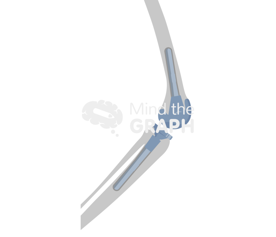 Short cemented stem cone lateral bone Icons, Symbols, Pictures, and Images