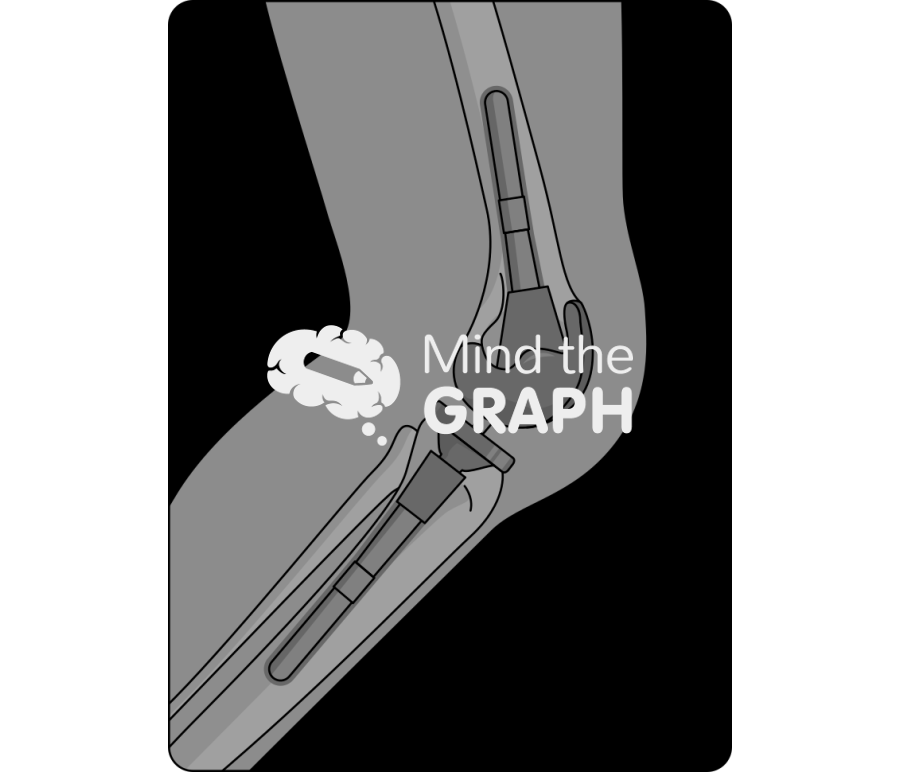 Short cemented stem cone lateral x ray Icons, Symbols, Pictures, and Images