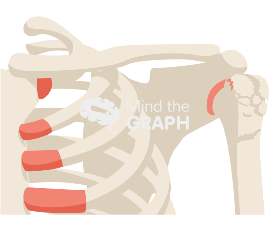 Shoulder fracture Icons, Symbols, Pictures, and Images