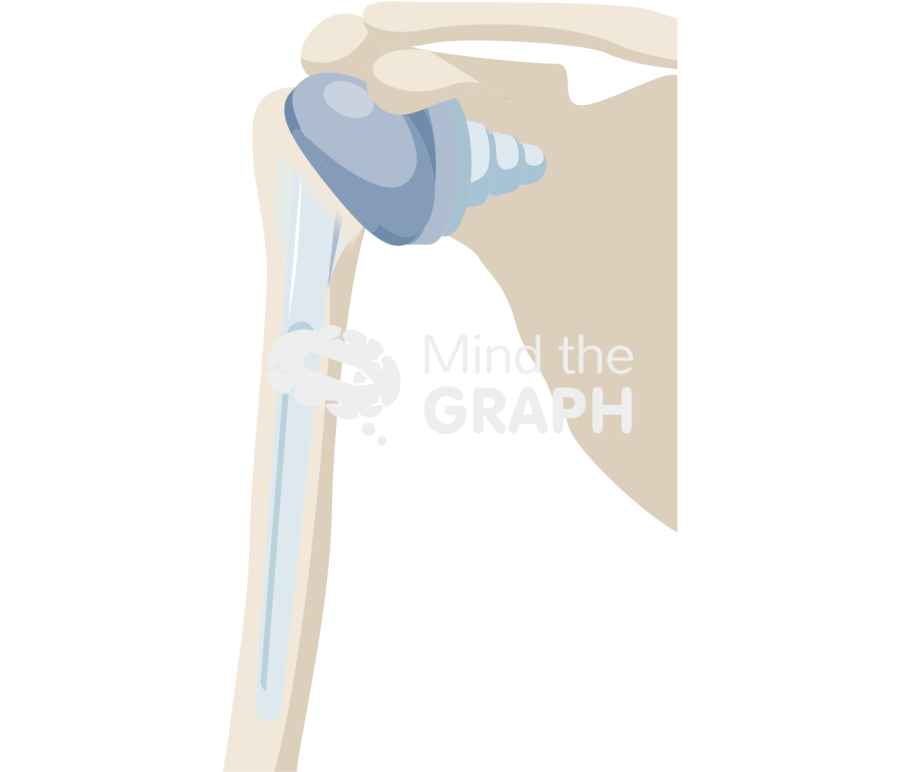 Shoulder replacement bone full Icons, Symbols, Pictures, and Images