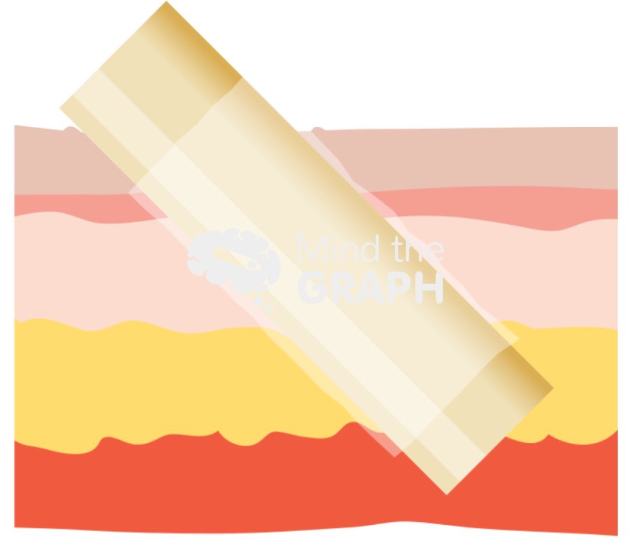 Silicone tube wrapped skin Icons, Symbols, Pictures, and Images