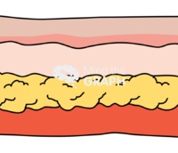 Skin epidermis dermis subcutaneous tissue 1 Icons, Symbols, Pictures, and Images