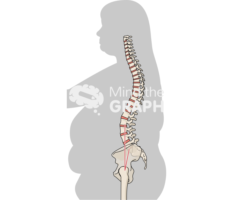 Skin patch test obese bone Icons, Symbols, Pictures, and Images