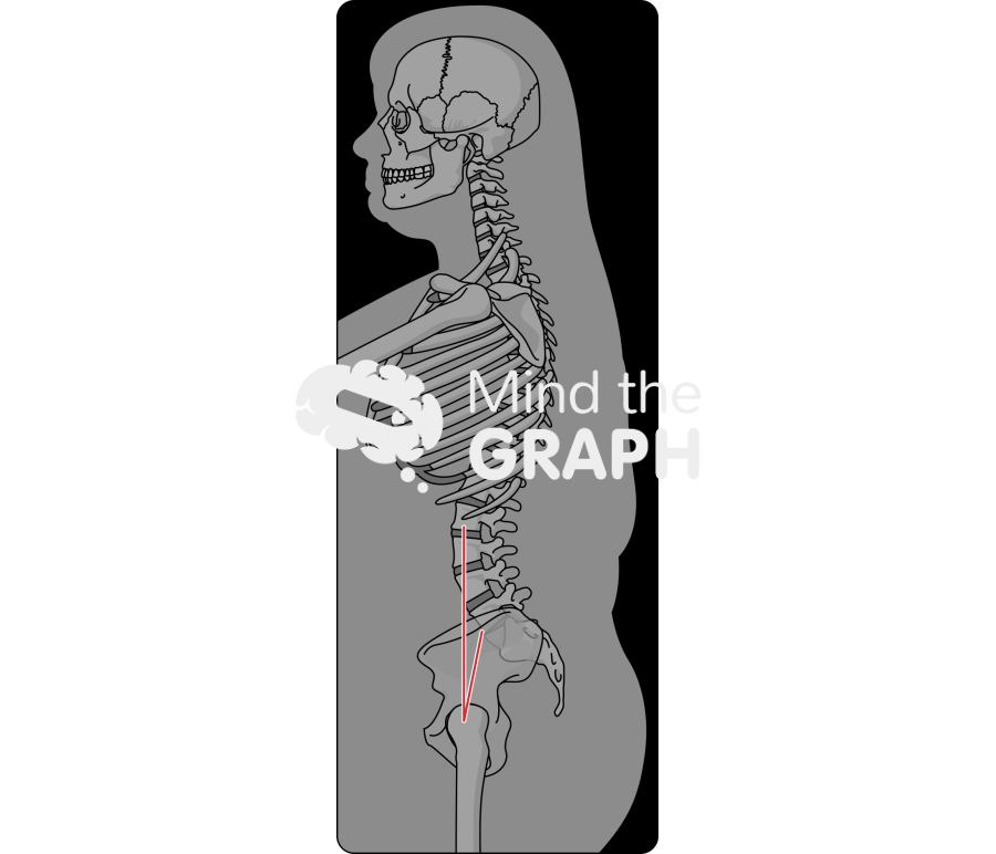 Skin patch test obese standing x ray Icons, Symbols, Pictures, and Images