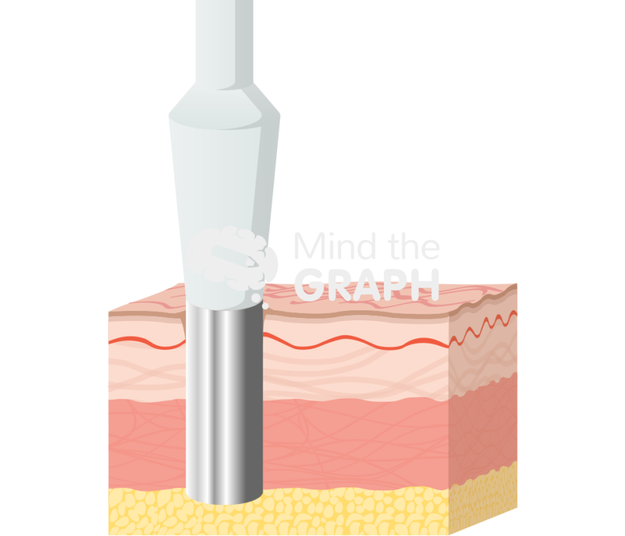 Skin punch biopsy Icons, Symbols, Pictures, and Images