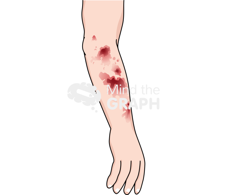 Solar purpura skin Icons, Symbols, Pictures, and Images