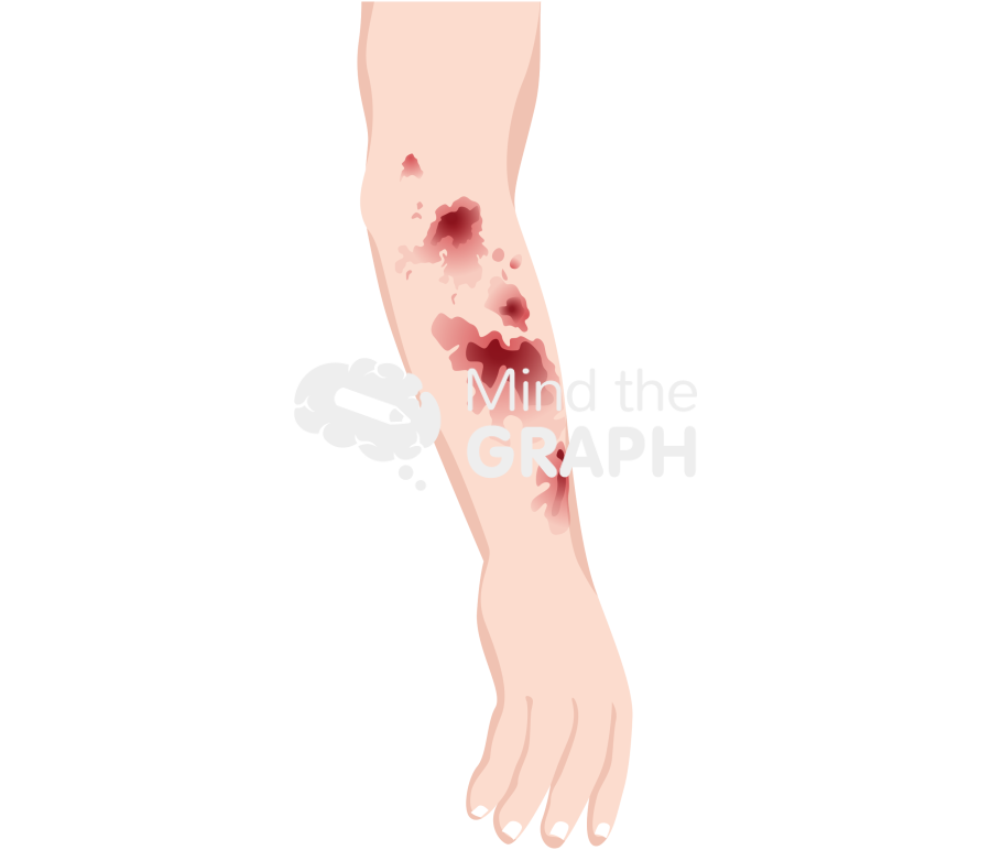 Solar purpura skin Icons, Symbols, Pictures, and Images