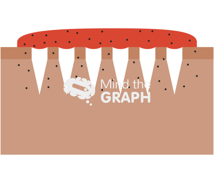 Solid removable microneedles tissue Icons, Symbols, Pictures, and Images
