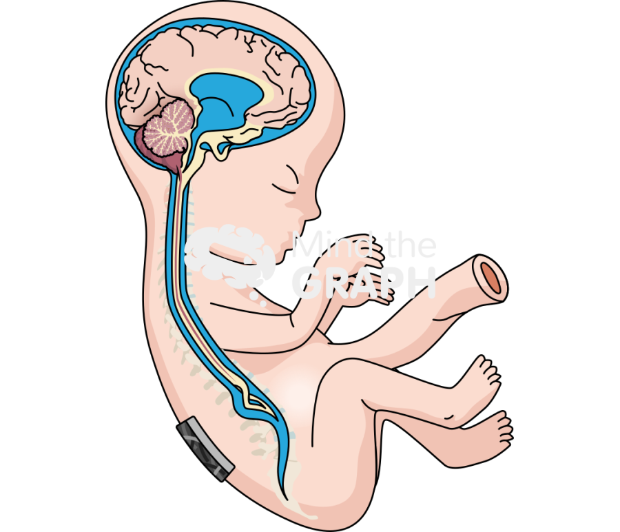 Spina bifida electrospun patch Icons, Symbols, Pictures, and Images