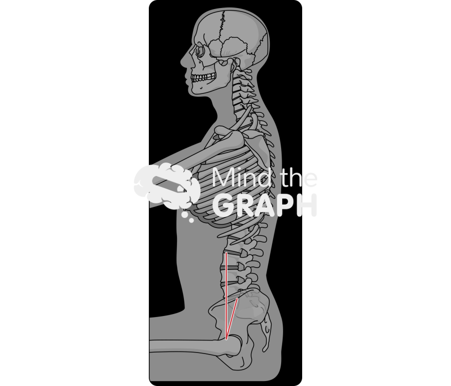 Spinopelvic tilt normal body mass index sitting x ray Icons, Symbols, Pictures, and Images