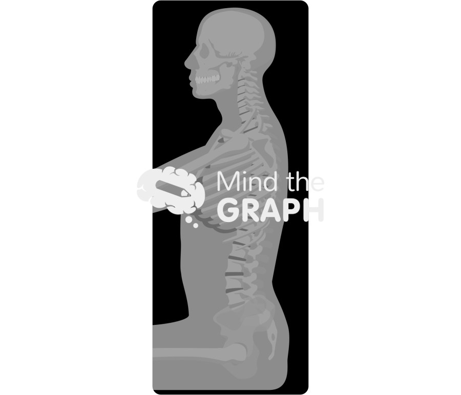 Spinopelvic tilt normal body mass index sitting x ray Icons, Symbols, Pictures, and Images