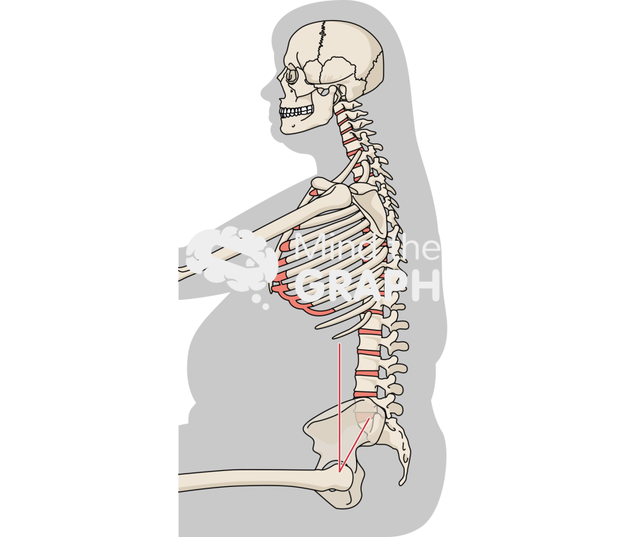 Spinopelvic tilt obese sitting Icons, Symbols, Pictures, and Images
