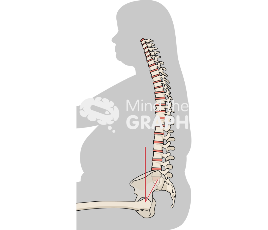 Spinopelvic tilt obese sitting bone Icons, Symbols, Pictures, and Images