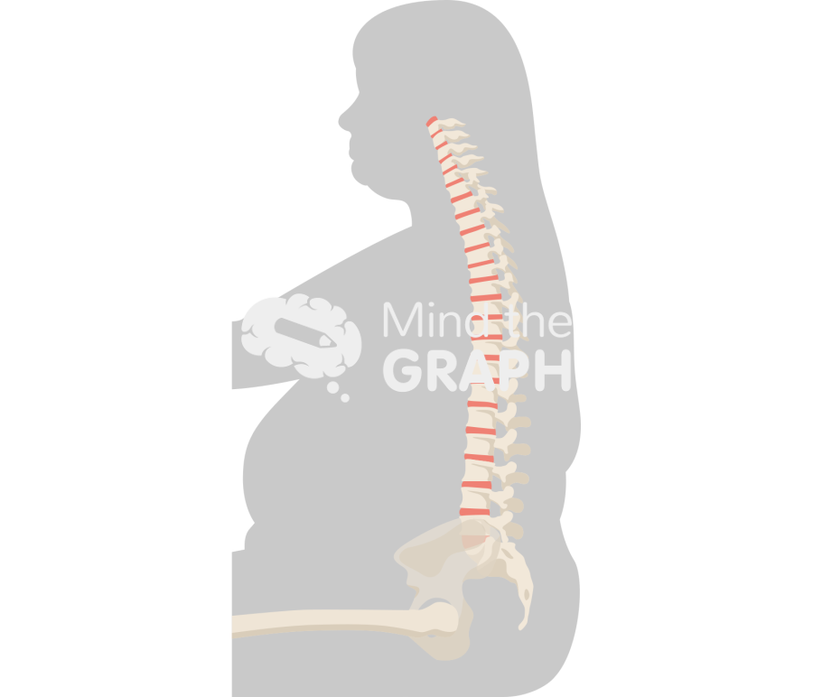 Spinopelvic tilt obese sitting bone Icons, Symbols, Pictures, and Images
