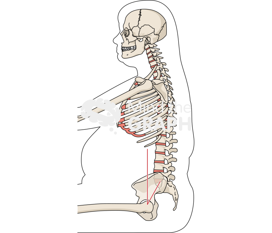 Spinopelvic tilt obese sitting bone full Icons, Symbols, Pictures, and Images