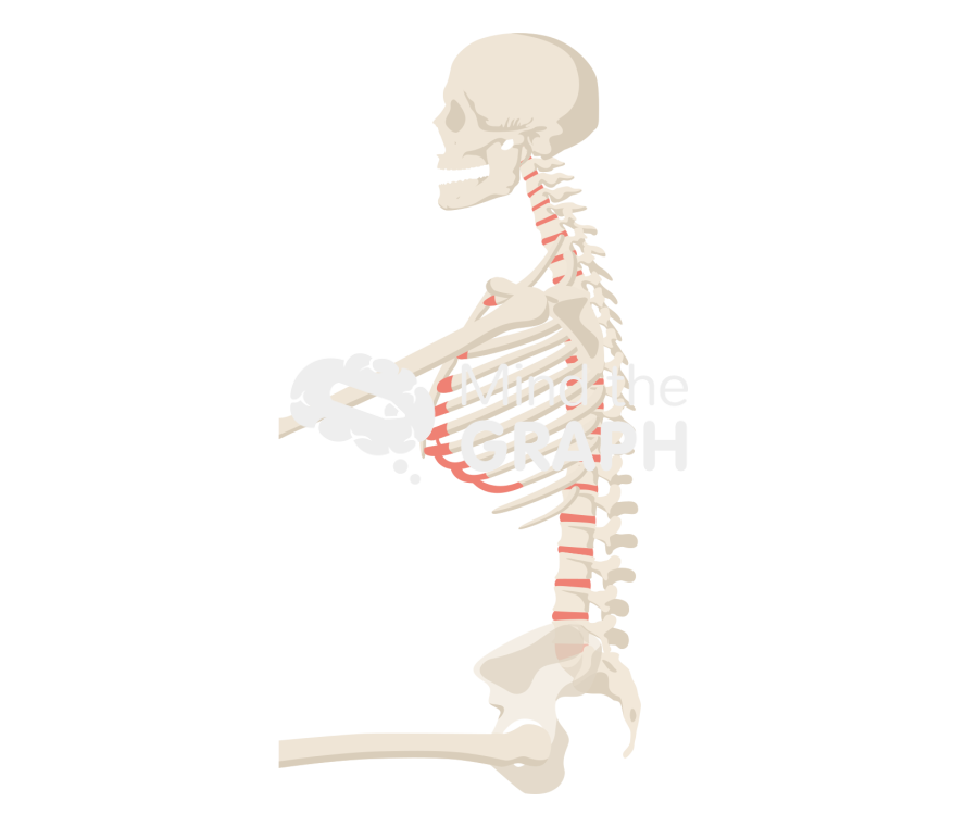 Spinopelvic tilt obese sitting bone full Icons, Symbols, Pictures, and Images