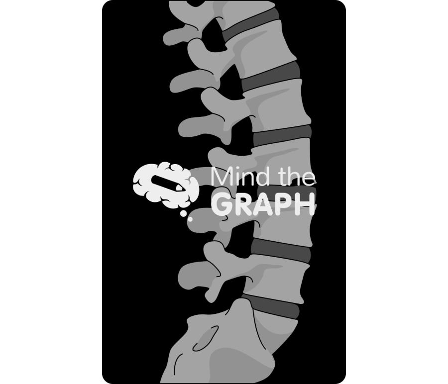 Spondylodiscitis ct scan l3 l4 disc Icons, Symbols, Pictures, and Images