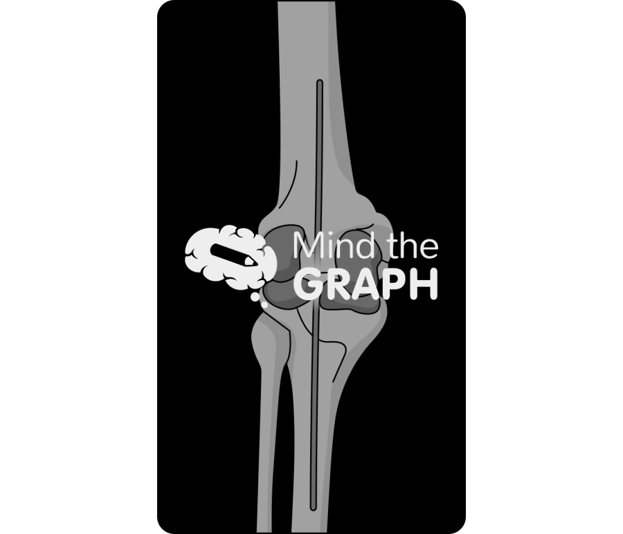 Static abx spacer anteroposterior x ray Icons, Symbols, Pictures, and Images