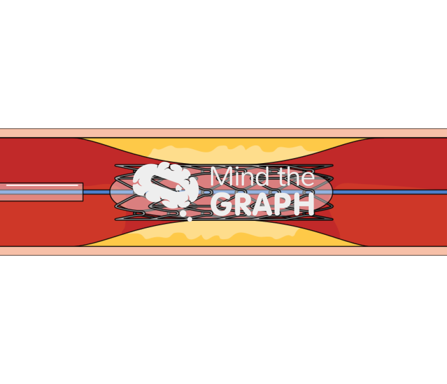 Stent baloon 1 Icons, Symbols, Pictures, and Images