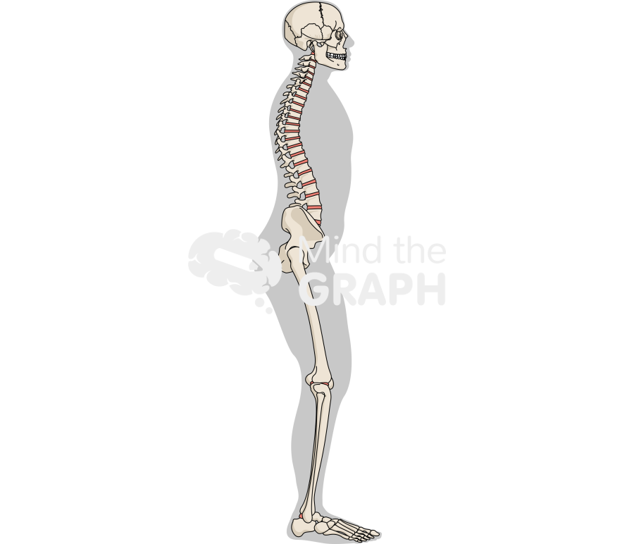 Stiff person syndrome lateral Icons, Symbols, Pictures, and Images