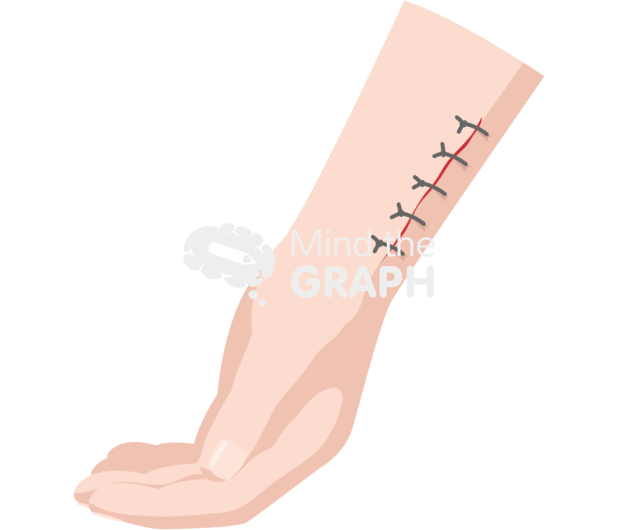 Stitches suture Icons, Symbols, Pictures, and Images