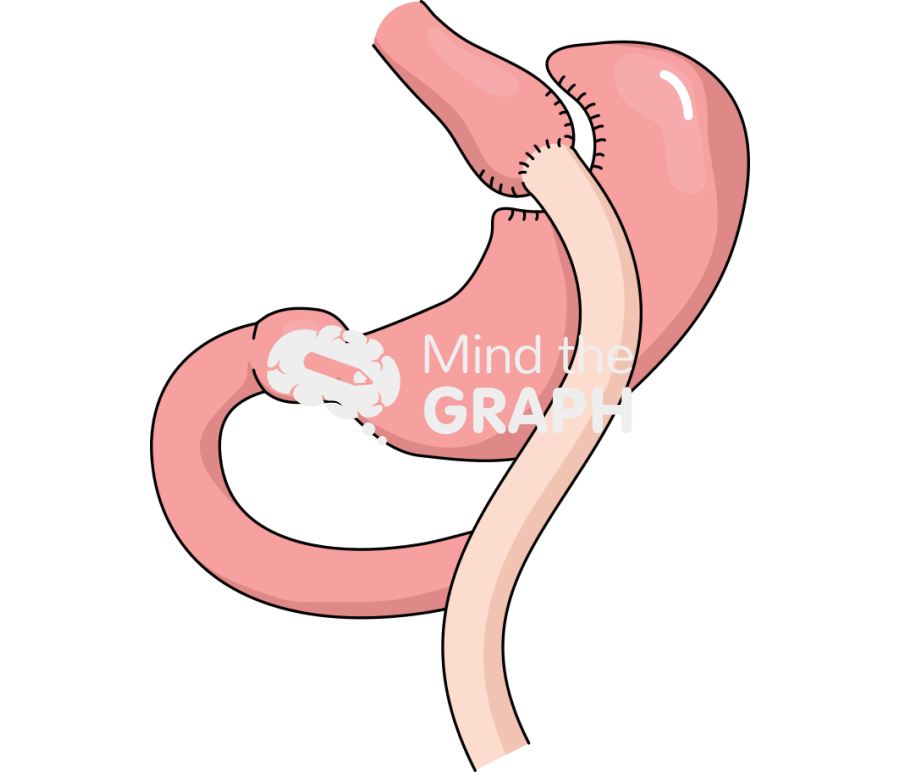 Stomach gastric bypass 2 Icons, Symbols, Pictures, and Images