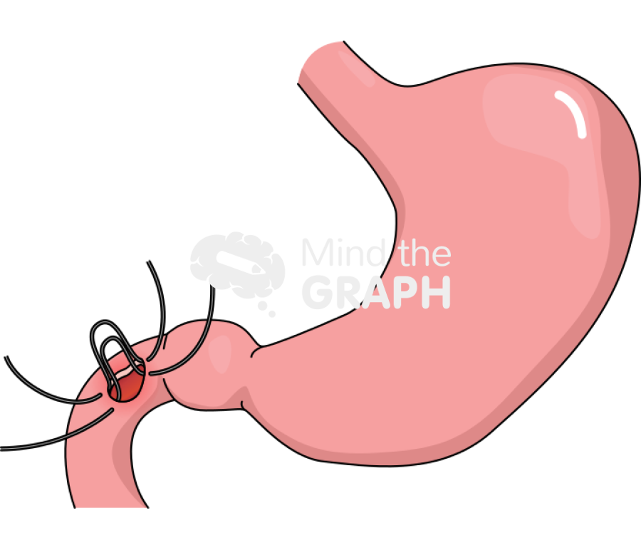 Stomach graham patch 1 Icons, Symbols, Pictures, and Images