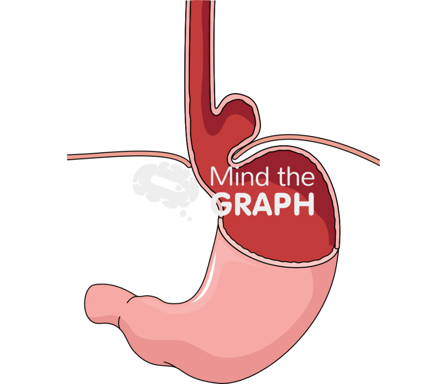 Stomach mixed hernia Icons, Symbols, Pictures, and Images