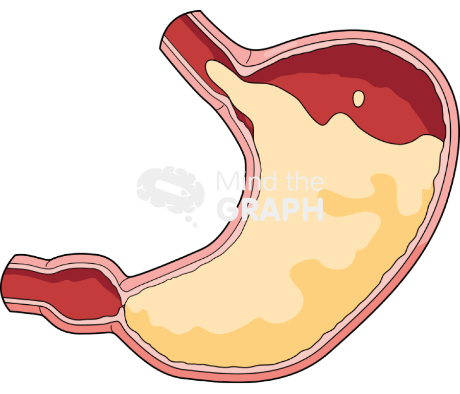 Stomach open sphincter gastroesophageal reflux Icons, Symbols, Pictures, and Images