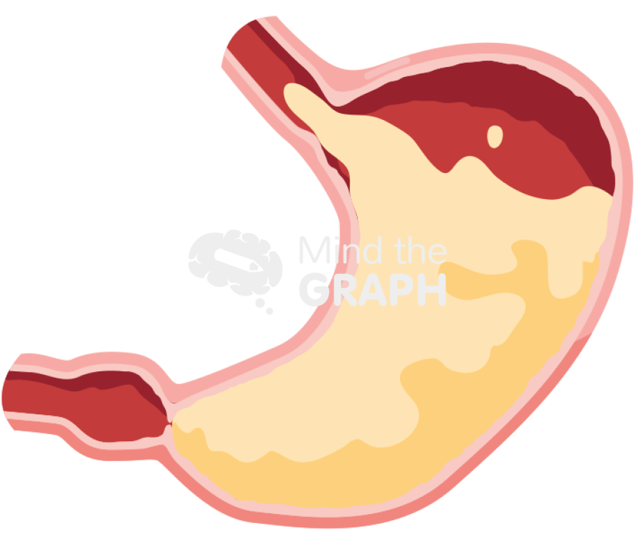 Stomach open sphincter gastroesophageal reflux Icons, Symbols, Pictures, and Images
