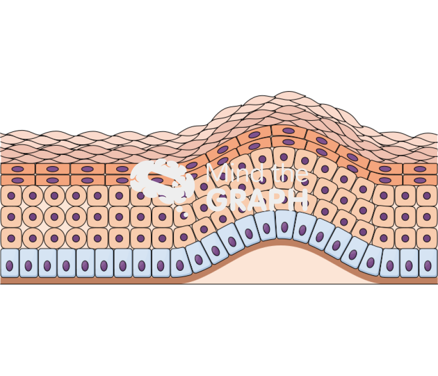 Subepidermal blister skin Icons, Symbols, Pictures, and Images