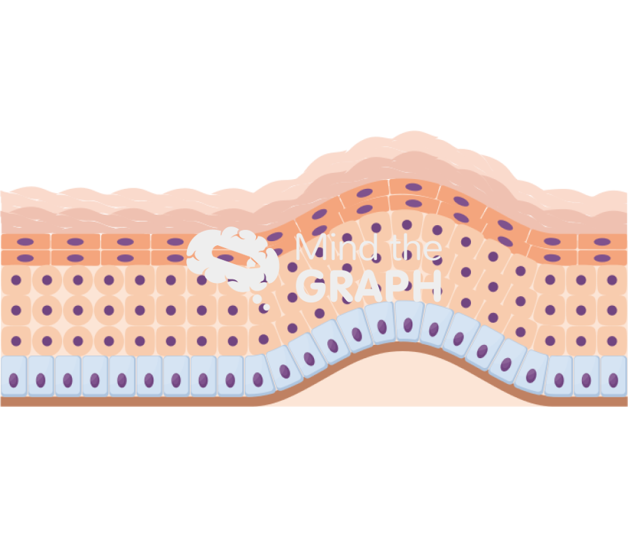 Subepidermal blister skin Icons, Symbols, Pictures, and Images