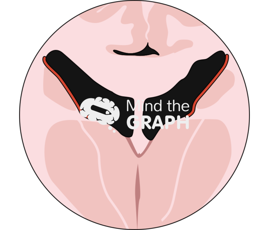 Subventricular zone coronal view zoom Icons, Symbols, Pictures, and Images