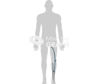 Superficial venous system 2 - Edit and Customize Icons of Superficial venous system 2 Superficial venous system 2 Icons, Symbols, Pictures, and Images