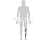 Superficial venous system 3 - Edit and Customize Icons of Superficial venous system 3 Superficial venous system 3 Icons, Symbols, Pictures, and Images