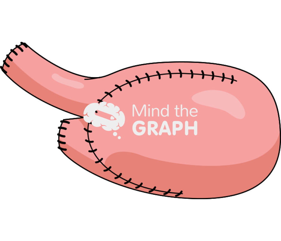 Surgery small intestine bladder 4 Icons, Symbols, Pictures, and Images