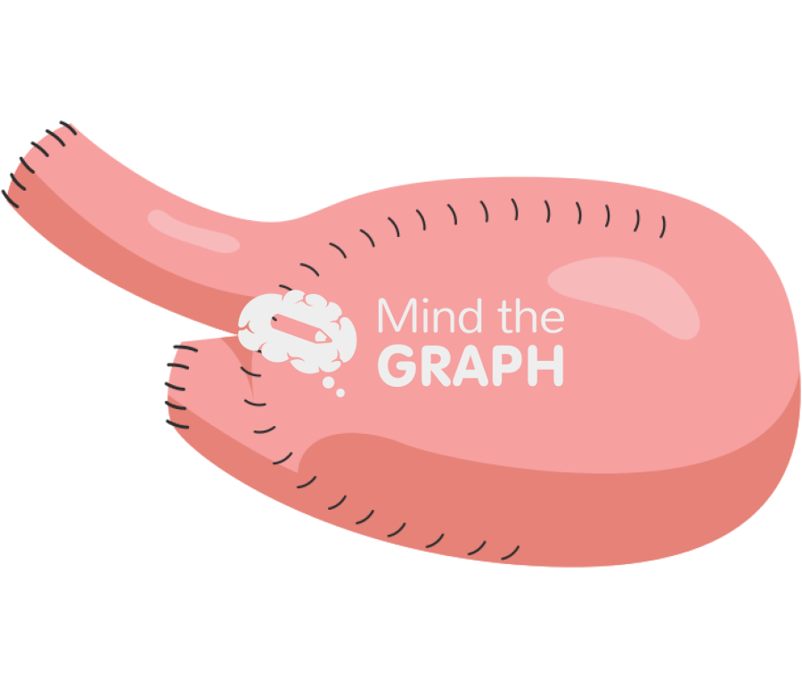 Surgery small intestine bladder 4 Icons, Symbols, Pictures, and Images