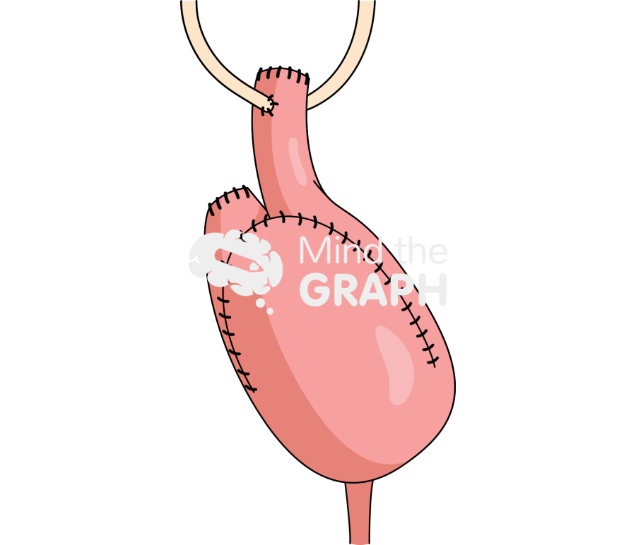 Surgery small intestine bladder 5 Icons, Symbols, Pictures, and Images