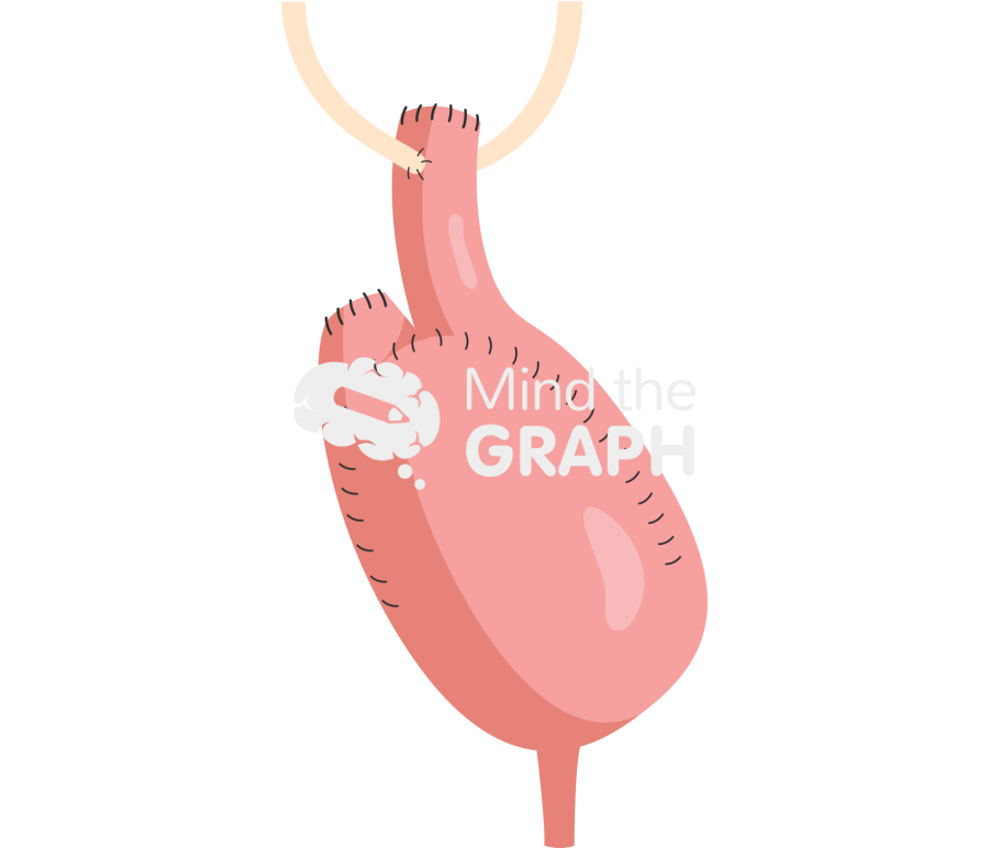 Surgery small intestine bladder 5 Icons, Symbols, Pictures, and Images