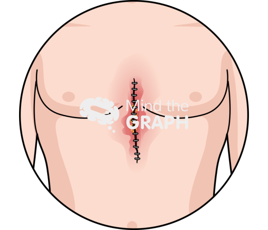Surgery thorax inflamation zoom Icons, Symbols, Pictures, and Images