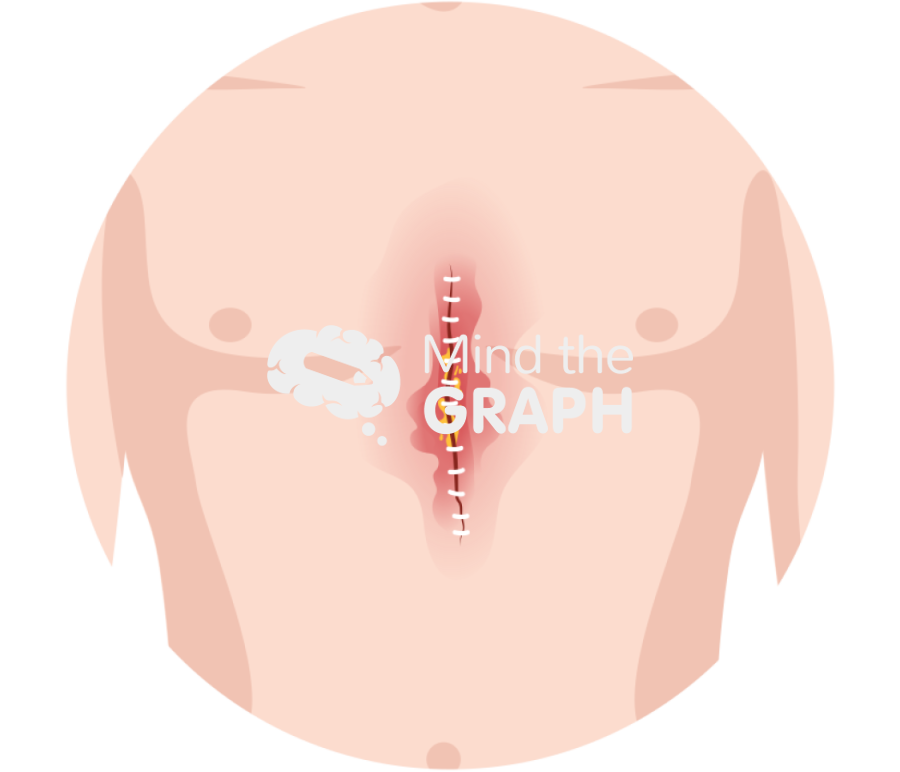 Surgery thorax inflamation zoom Icons, Symbols, Pictures, and Images