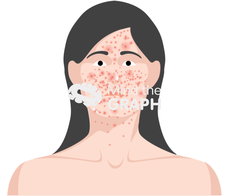 Systemic lupus erythematosus Icons, Symbols, Pictures, and Images