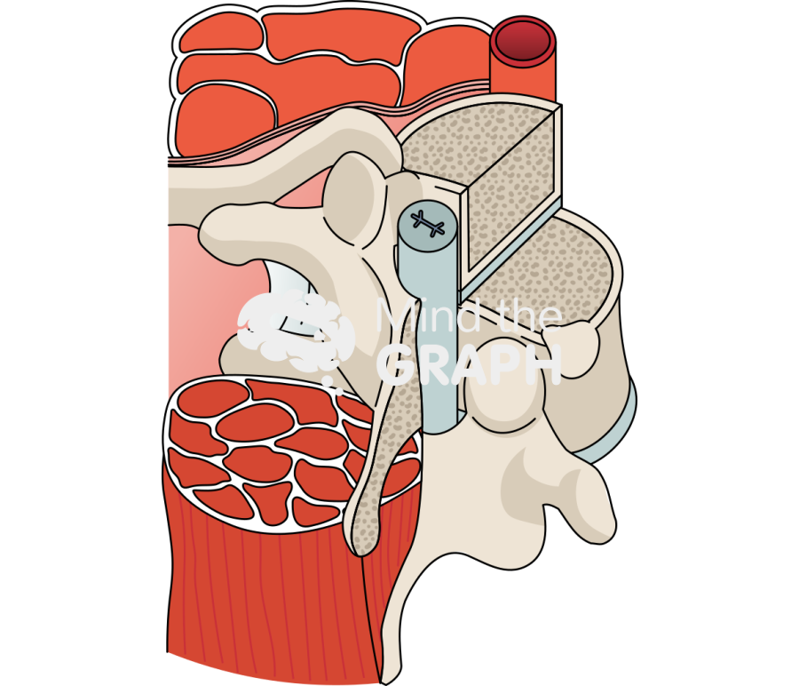 T6 t7 spinal cord cross section Icons, Symbols, Pictures, and Images