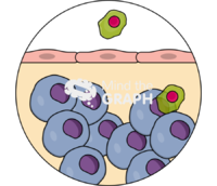 T cell infiltration2 Icons, Symbols, Pictures, and Images