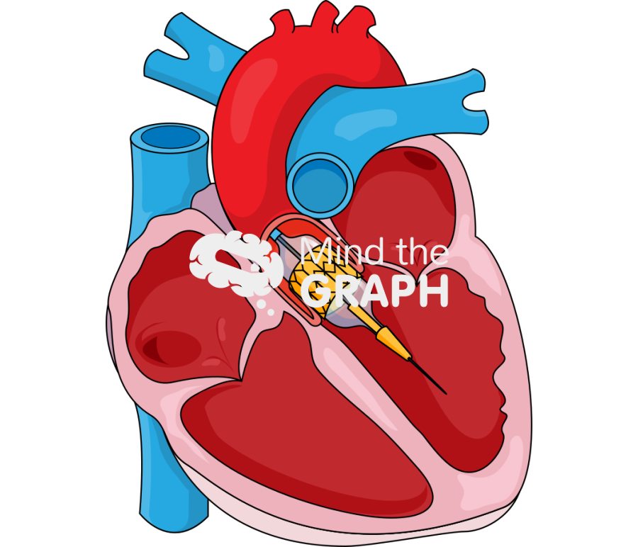 Tavr transcatheter aortic valve replacement 1 Icons, Symbols, Pictures, and Images